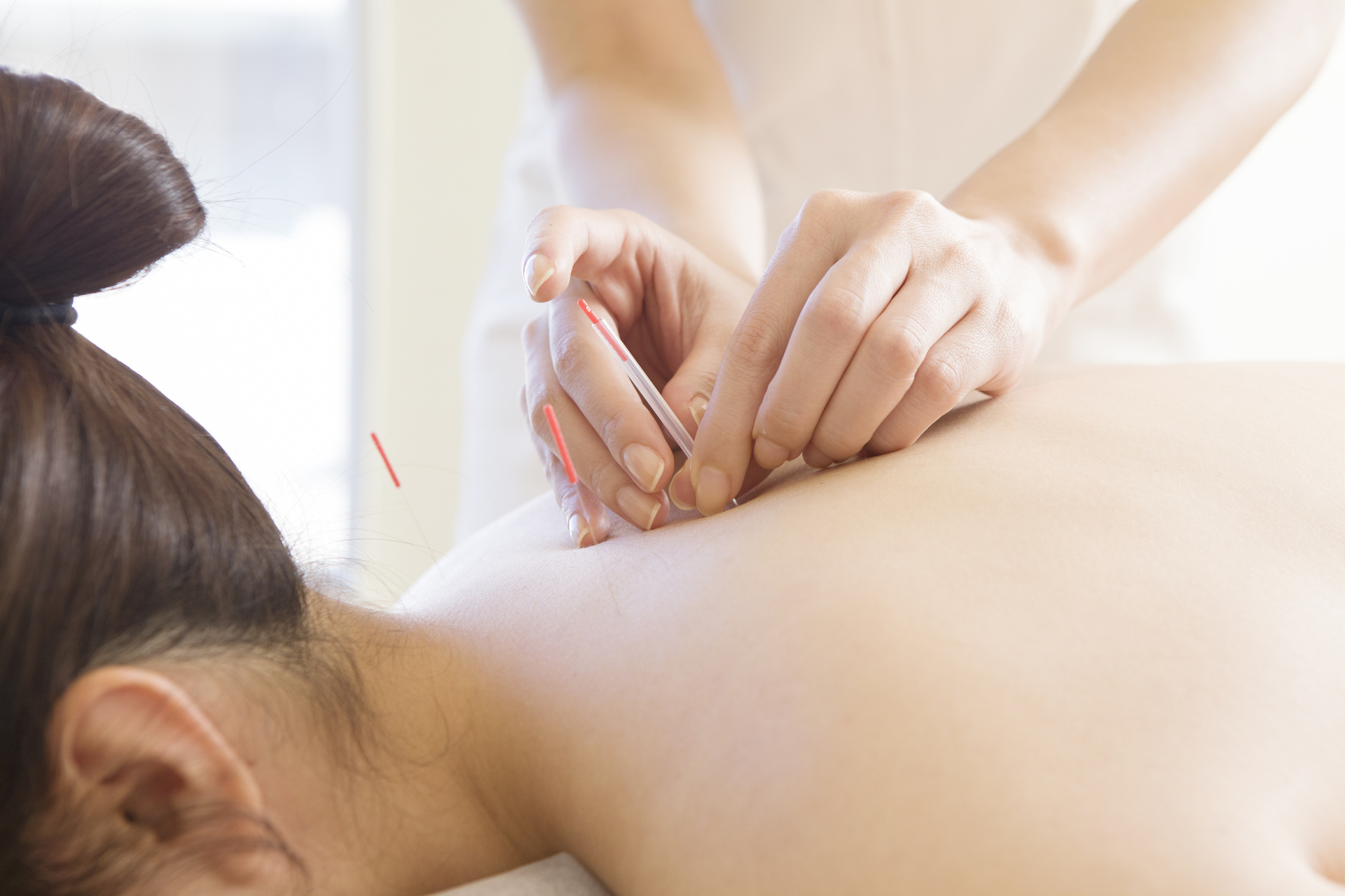 背中への負担をケア | 東京都用賀の鍼灸院ならいしはら鍼灸接骨院