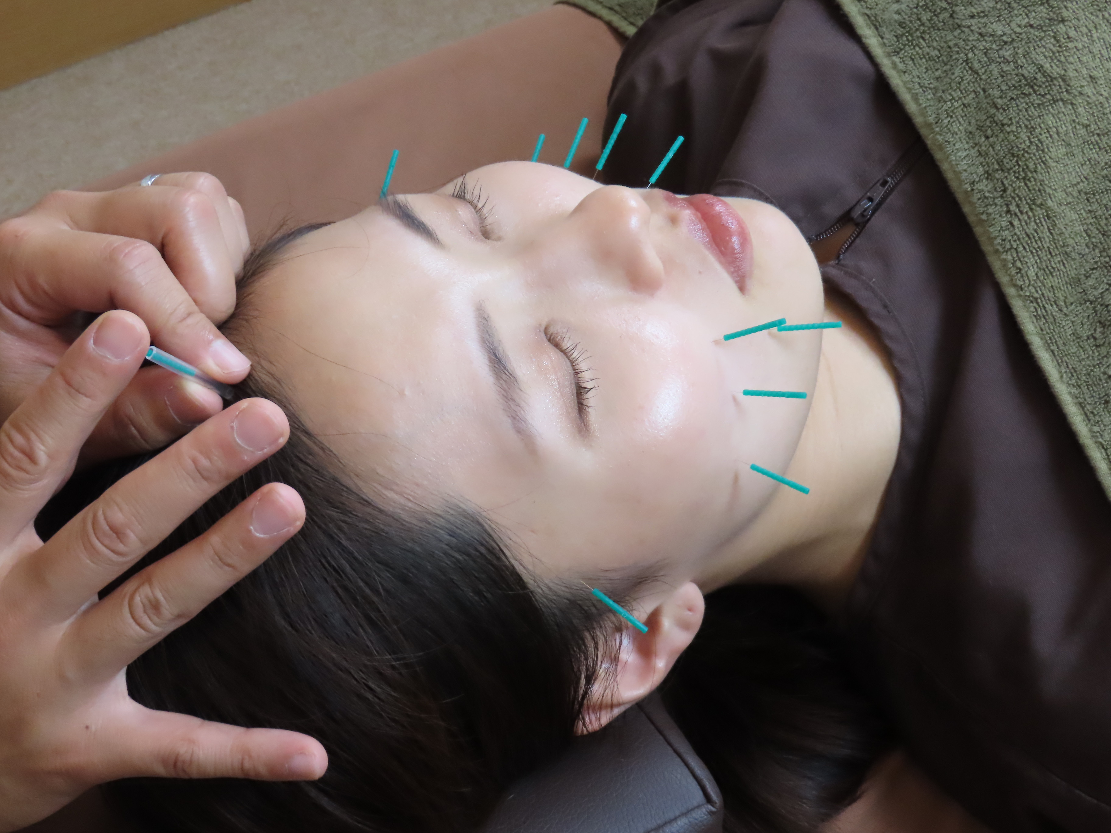 たるみ対策の施術内容